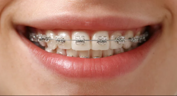 Pediatric Dentistry